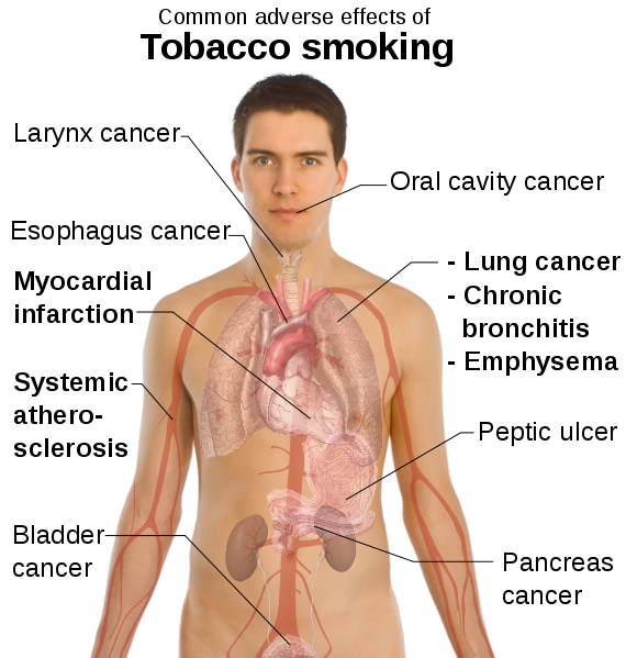 effects of smoking.png